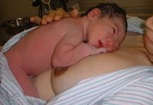 写真：生まれてすぐ母親の胸に抱かれている赤ちゃん